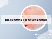 为什么腿内侧总是长藓 为什么大腿内侧长藓