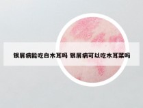 银屑病能吃白木耳吗 银屑病可以吃木耳菜吗