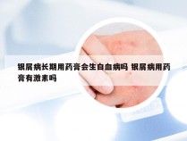 银屑病长期用药膏会生白血病吗 银屑病用药膏有激素吗