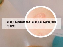 新生儿起疙瘩带白点 新生儿起小疙瘩,带着小白尖