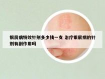 银屑病特效针剂多少钱一支 治疗银屑病的针剂有副作用吗