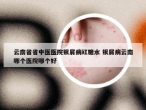 云南省省中医医院银屑病红糖水 银屑病云南哪个医院哪个好