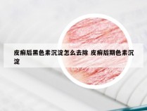 皮癣后黑色素沉淀怎么去除 皮癣后期色素沉淀