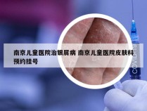 南京儿童医院治银屑病 南京儿童医院皮肤科预约挂号