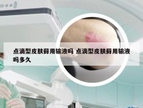 点滴型皮肤藓用输液吗 点滴型皮肤藓用输液吗多久