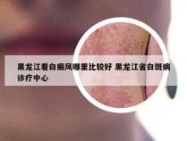 黑龙江看白癜风哪里比较好 黑龙江省白斑病诊疗中心