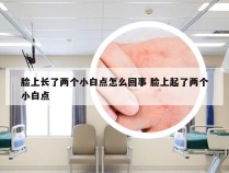 脸上长了两个小白点怎么回事 脸上起了两个小白点