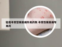 轻度寻常型银屑病外用药物 寻常性银屑病专用药