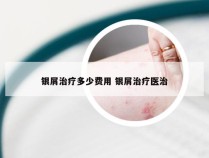 银屑治疗多少费用 银屑治疗医治