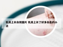 乳房上长白斑图片 乳房上长了好多白色的小点