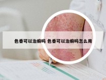 色香可以治癣吗 色香可以治癣吗怎么用