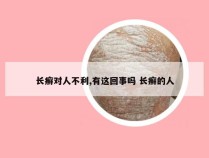 长癣对人不利,有这回事吗 长癣的人