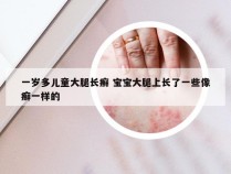 一岁多儿童大腿长癣 宝宝大腿上长了一些像癣一样的