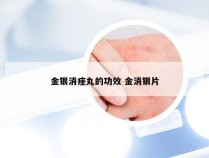 金银消痤丸的功效 金消银片