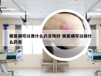 银屑病可以用什么药膏擦好 银屑病可以抹什么药膏