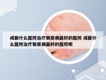 成都什么医院治疗银屑病最好的医院 成都什么医院治疗银屑病最好的医院呢