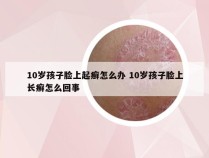 10岁孩子脸上起癣怎么办 10岁孩子脸上长癣怎么回事