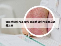 银屑病研究所正规吗 银屑病研究所是私立还是公立