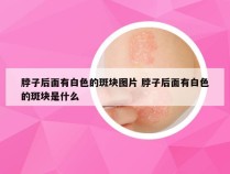 脖子后面有白色的斑块图片 脖子后面有白色的斑块是什么