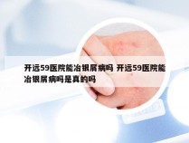 开远59医院能冶银屑病吗 开远59医院能冶银屑病吗是真的吗