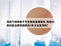 海南气候有助于牛皮癣患者康复吗 海南66真的能治银屑病真的3年才会复发吗?