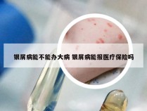 银屑病能不能办大病 银屑病能报医疗保险吗