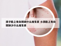 孩子脸上有白斑缺什么维生素 小孩脸上有白斑缺少什么维生素