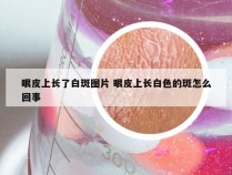 眼皮上长了白斑图片 眼皮上长白色的斑怎么回事