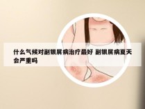 什么气候对副银屑病治疗最好 副银屑病夏天会严重吗