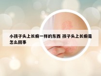 小孩子头上长癣一样的东西 孩子头上长癣是怎么回事