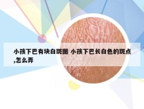 小孩下巴有块白斑图 小孩下巴长白色的斑点,怎么弄