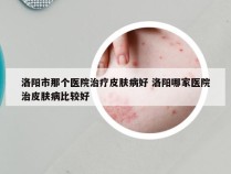 洛阳市那个医院治疗皮肤病好 洛阳哪家医院治皮肤病比较好