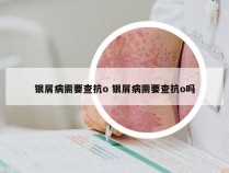 银屑病需要查抗o 银屑病需要查抗o吗