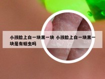 小孩脸上白一块黑一块 小孩脸上白一块黑一块是有蛔虫吗