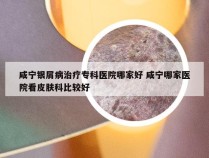 咸宁银屑病治疗专科医院哪家好 咸宁哪家医院看皮肤科比较好