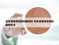 吉林省哪家皮肤科医院好 吉林省哪家皮肤科医院好点