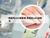 希格玛ss01银屑病 希格玛ss01说明书