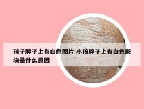 孩子脖子上有白色图片 小孩脖子上有白色斑块是什么原因