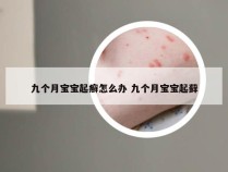 九个月宝宝起癣怎么办 九个月宝宝起藓