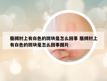 胳膊肘上有白色的斑块是怎么回事 胳膊肘上有白色的斑块是怎么回事图片