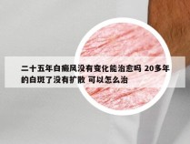 二十五年白癜风没有变化能治愈吗 20多年的白斑了没有扩散 可以怎么治