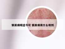 银屑病喷适今可 银屑病用什么喷剂