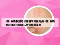 打针生物制剂可以控制掌跖脓疱病 打针生物制剂可以控制掌跖脓疱病复发吗