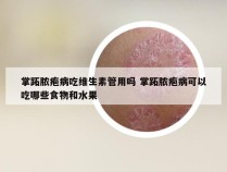 掌跖脓疱病吃维生素管用吗 掌跖脓疱病可以吃哪些食物和水果