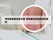 贵阳银屑病首推中康 贵阳最好的银屑病中医院