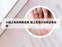 小腿上有白斑而且痒 腿上出现小白斑还有点痒