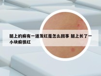 腿上的癣有一道发红是怎么回事 腿上长了一小块癣很红