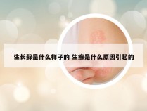 生长藓是什么样子的 生癣是什么原因引起的