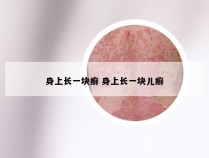 身上长一块癣 身上长一块儿癣