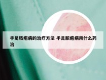 手足脓疱病的治疗方法 手足脓疱病用什么药治